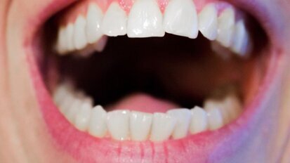 Botox A for OSMF: a novel therapeutic approach