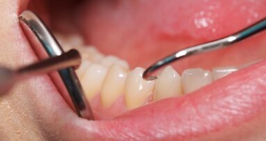 Slechte mondhygiëne beïnvloedt mogelijk covid-19-test