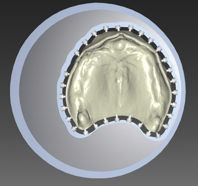 Fig. 16: Maxillary denture base connected to the blank via connectors in the nesting software.