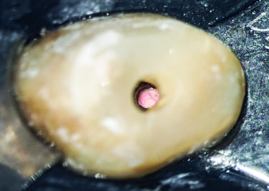 Fig.: 13