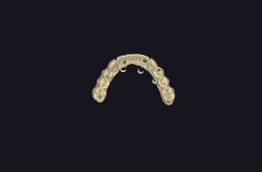 Fig. 12 - Progetto digitale.