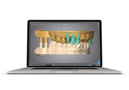 Dental Wings – DWOS Model Builder