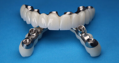 China to balance quality and price in bulk dental implant bids