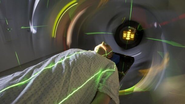 Nieuwe bestralingstechniek voorkomt droge mond