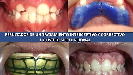El Dr. Arturo Alvarado sobre el Diplomado Internacional en Ortopedia Craneofacial