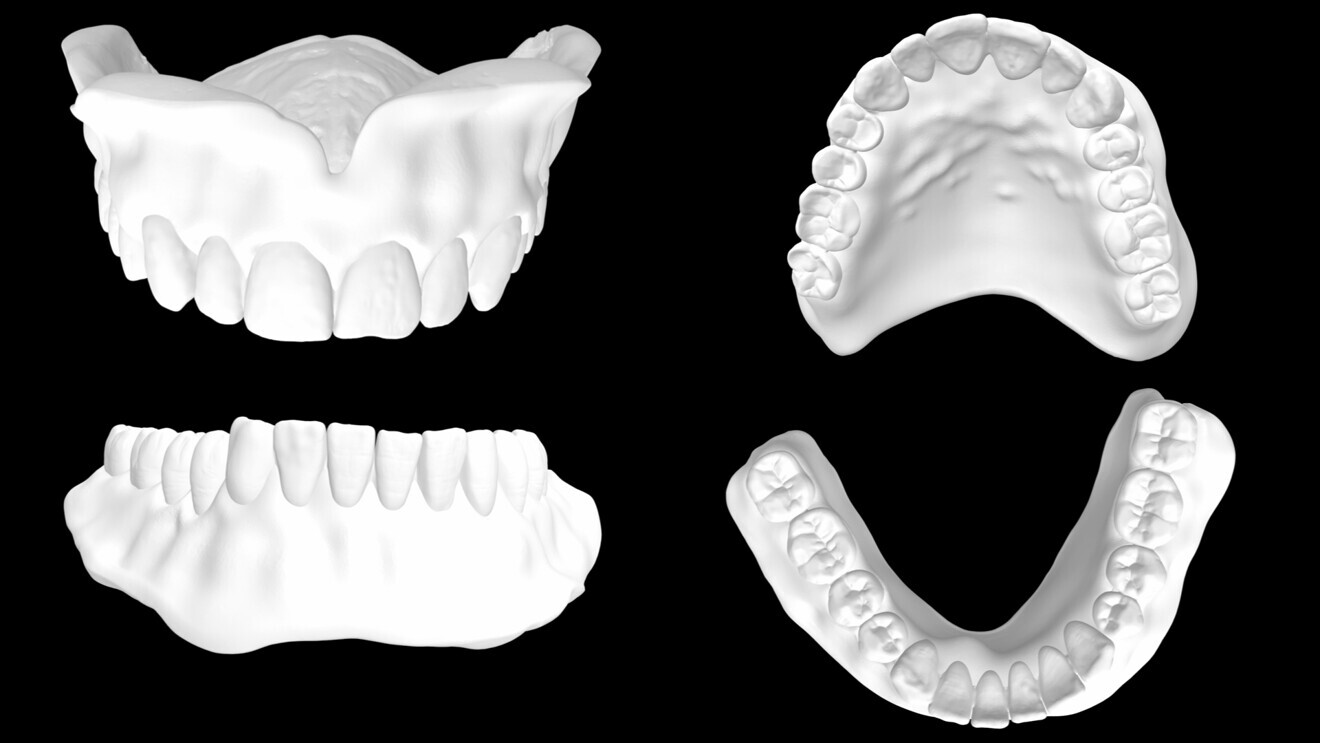 Fig. 7 : Conception virtuelle de la prothèse dentaire.