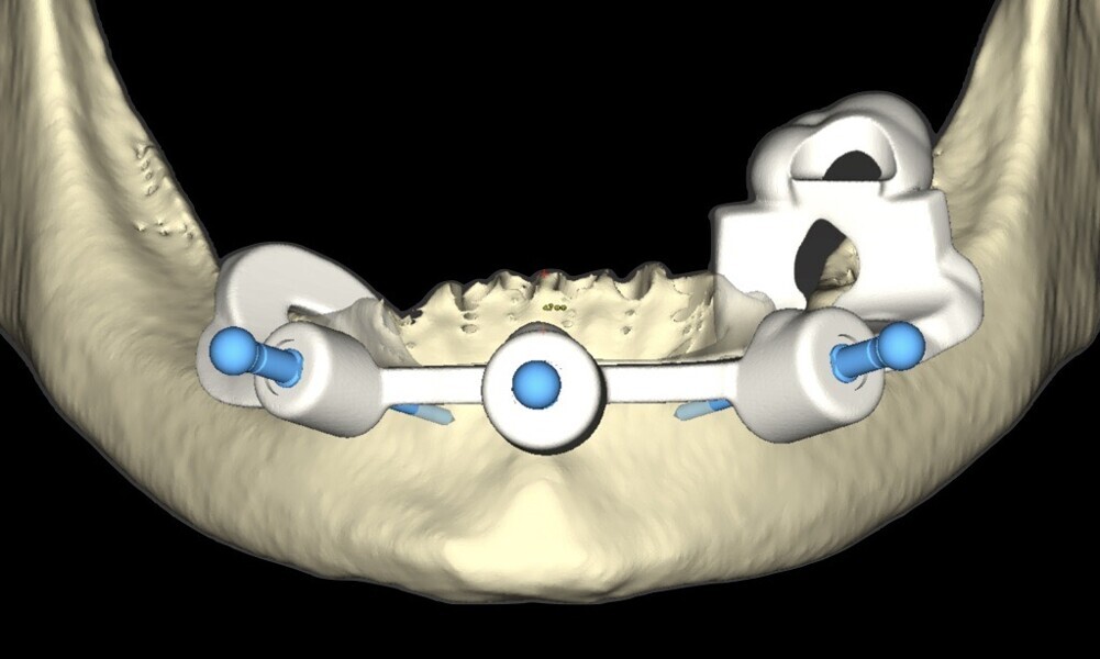 Fig. 37
