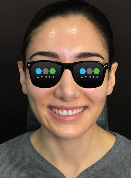 Fig. 11: Patient’s facial photograph after soft-tissue recontouring, direct restoration and whitening.