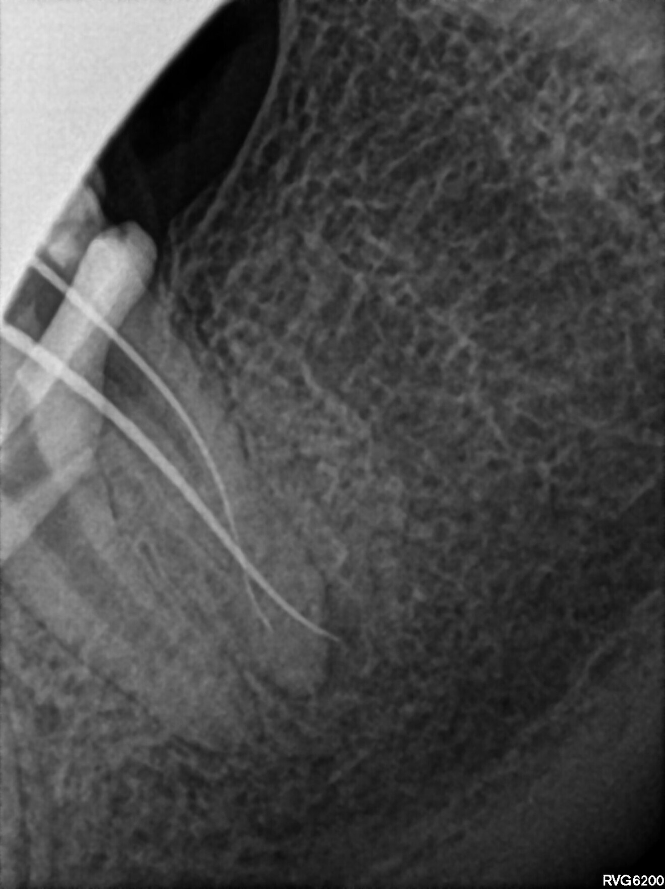 Fig. 19