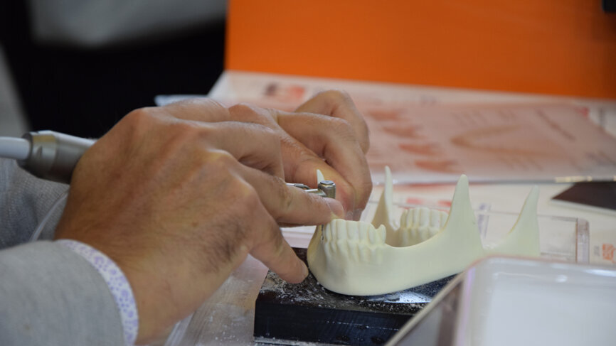 Live demonstration at the OSSTEM booth. 