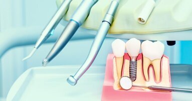 “Wij verkopen geen implantaten” - heroverweging nodig