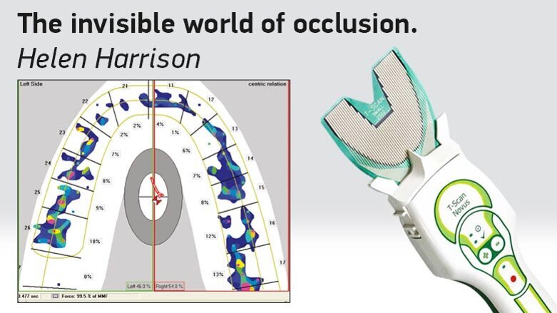 The invisible world of occlusion