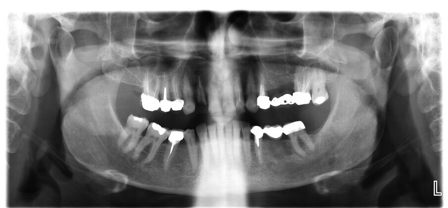 Fig. 6