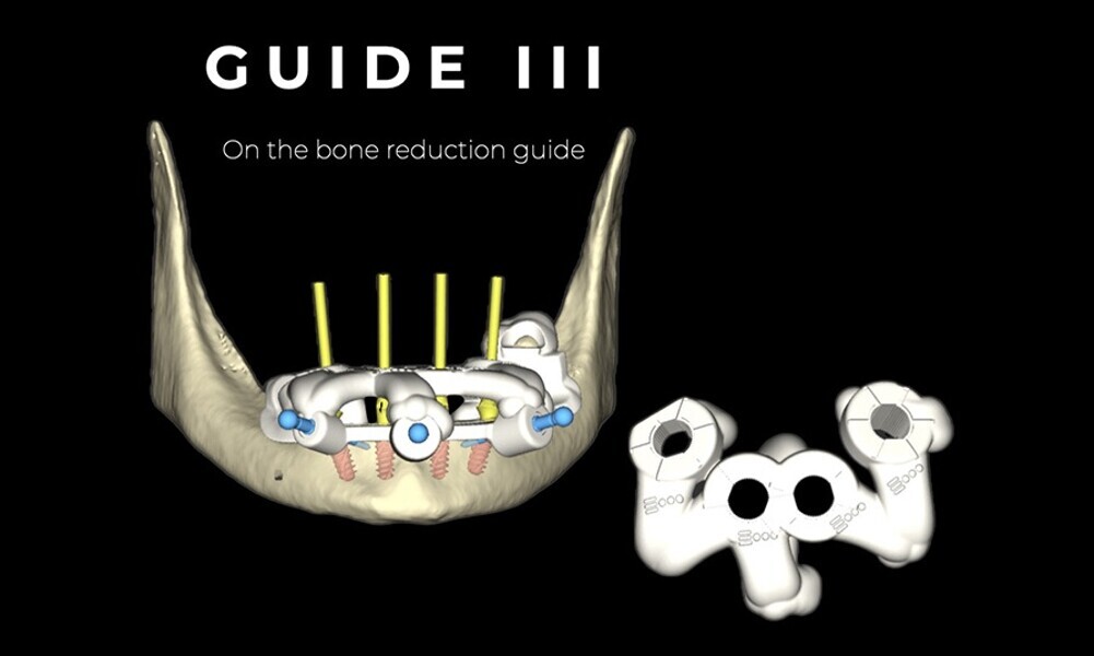 Fig. 24