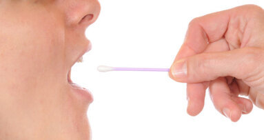 Estudo de assistência personalizada questiona a frequência de consultas dentárias