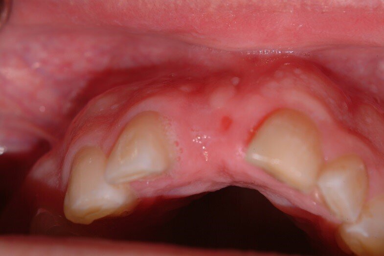 Fig. 7