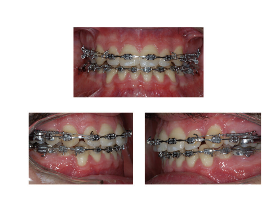 Fig. 4