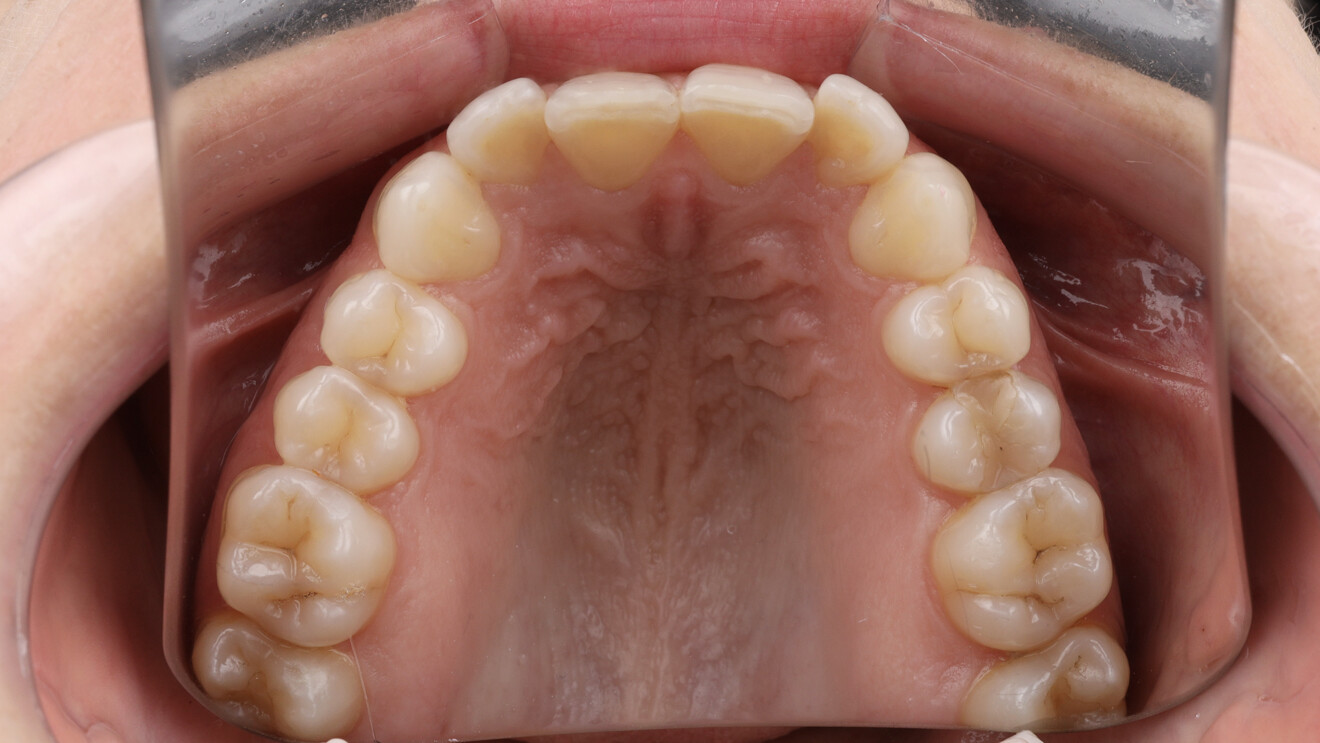 Fig. 8