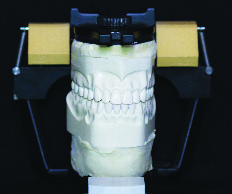 Fig. 12: VF mounted casts