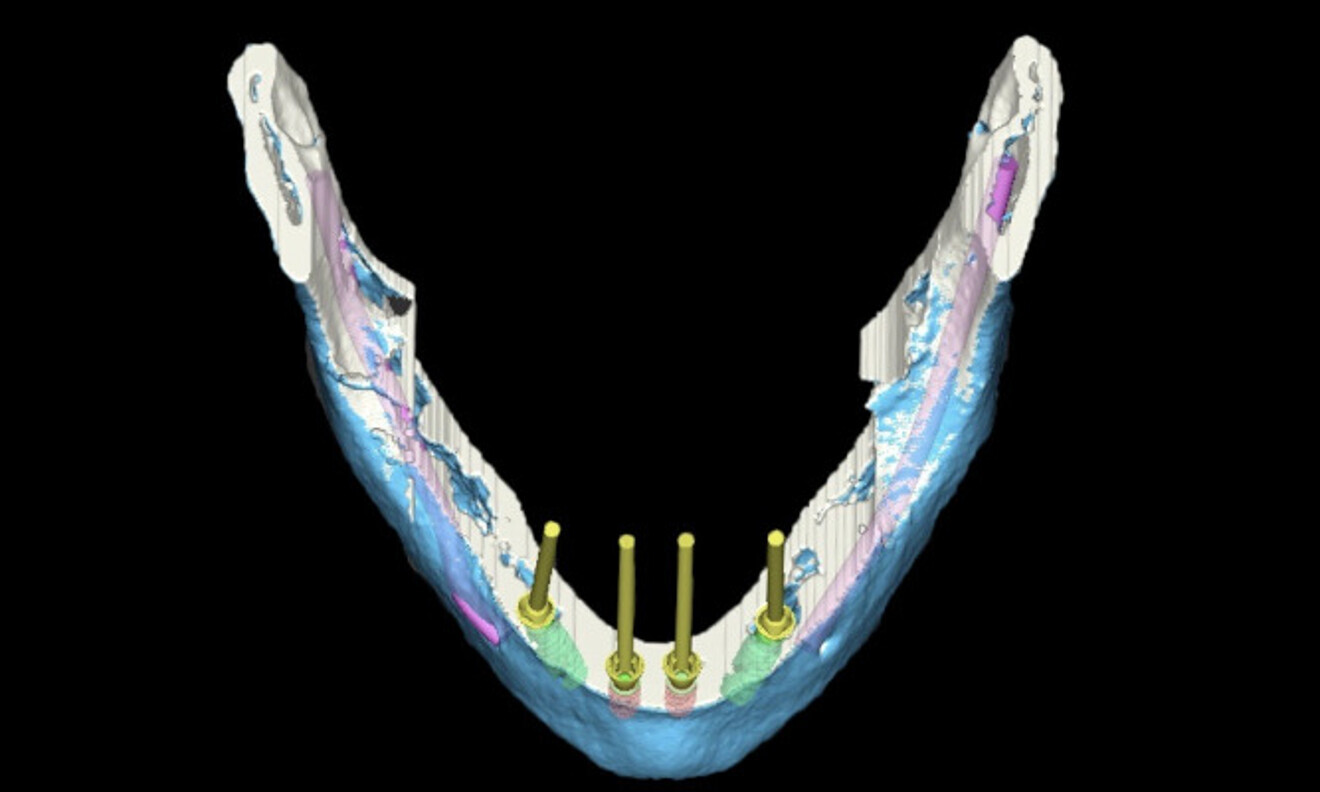 Fig. 5