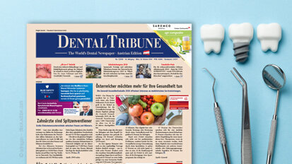 Jetzt online: Schwerpunkt Implantologie in der Dental Tribune Austria