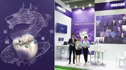 Exocad giới thiệu các giải pháp phần mềm mới nhất tại triển lãm Dental South China