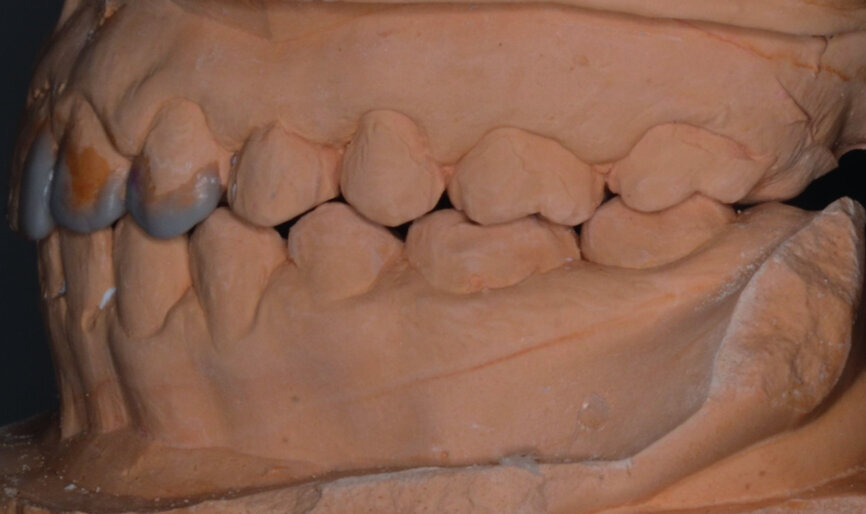 Fig. 39