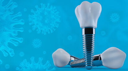 Interview on the impact of SARS-CoV-2 on dental implantology