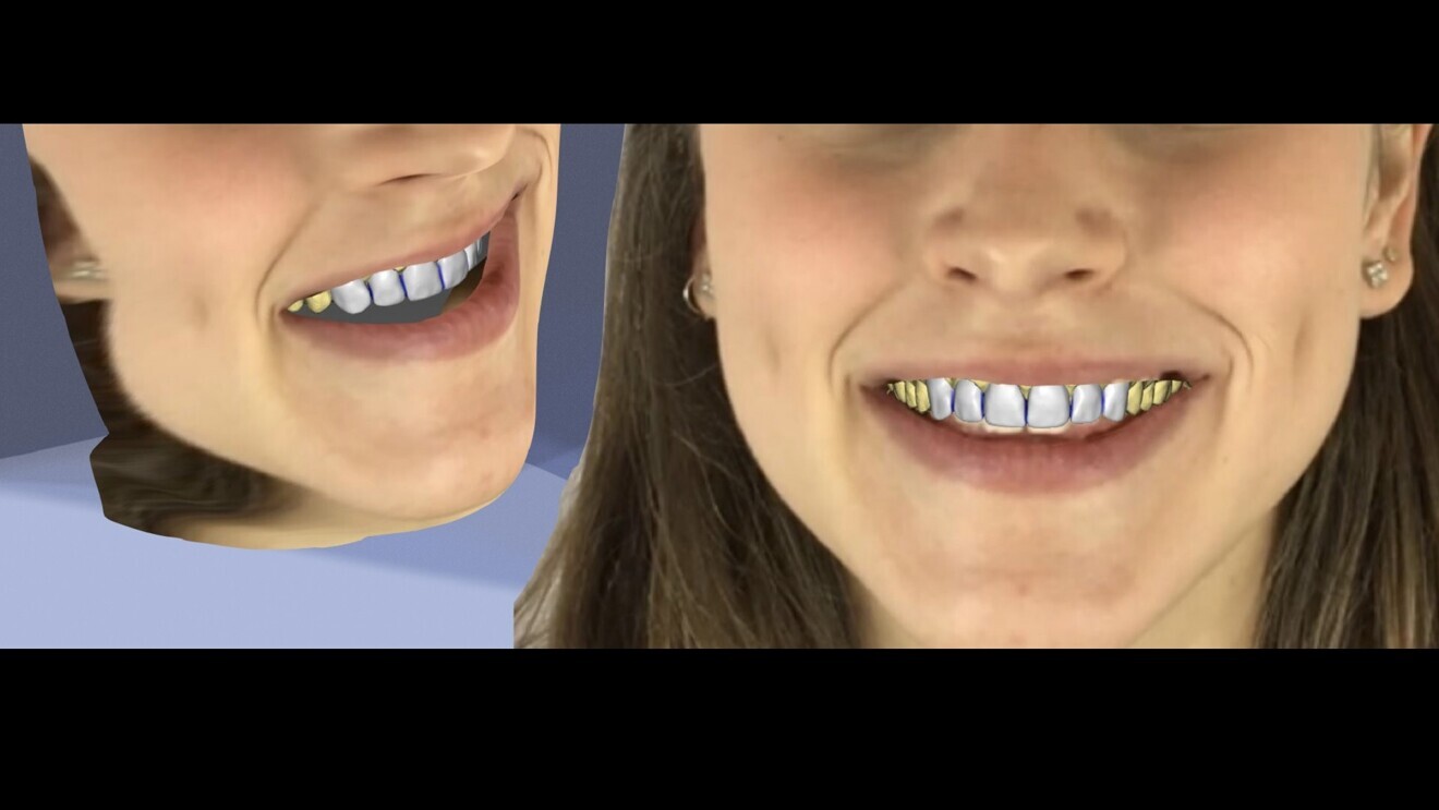 Fig. 9: Smile design in inLab CAD SW 22.0 (Dentsply Sirona).