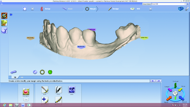 Restorative-driven implant therapy