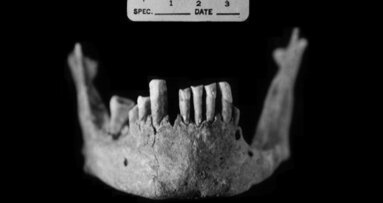 Ancient skeleton in India bears evidence of leprosy