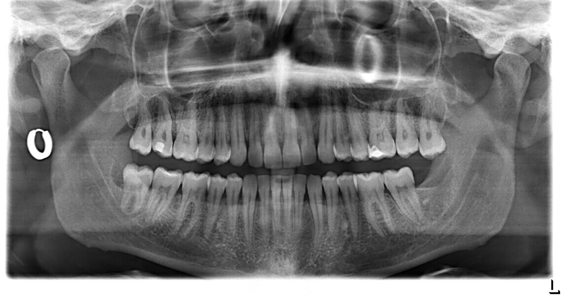 Fig. 34 