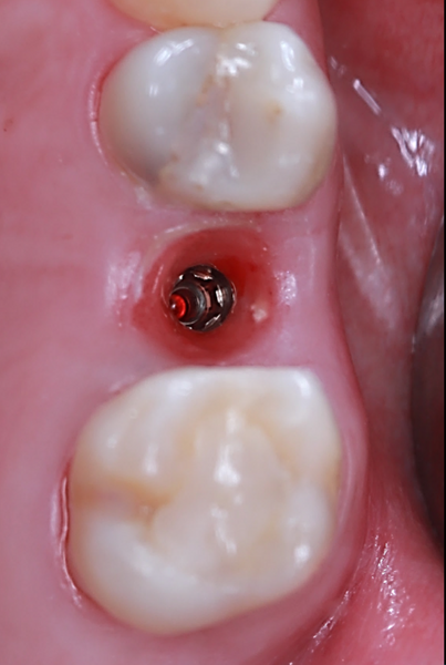 Fig. 17b