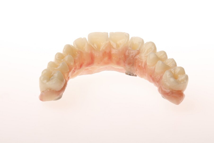 Fig. 3: Mock-up in PMMA with pink and white aesthetics.