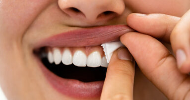 Danish Dental Association worried about irreversible damage caused by snus use