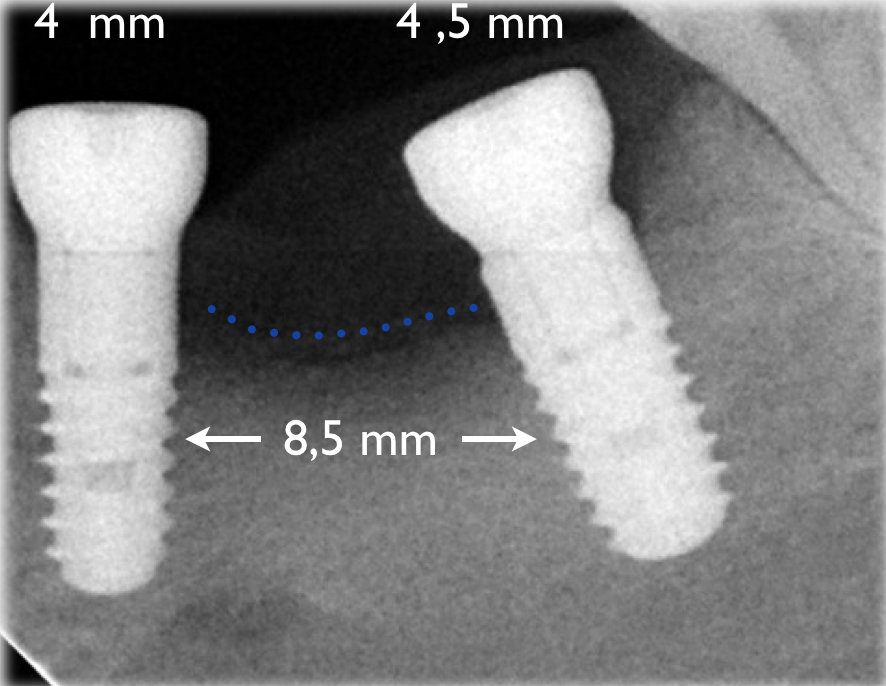Fig. 15