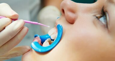Report confirms effectiveness of dental sealants against childhood caries