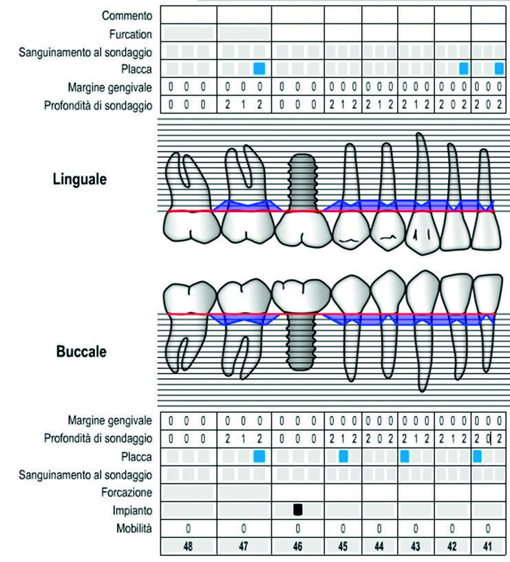 Fig. 30