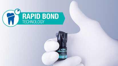 Die Rapid-Bond-Technologie: Bietet schnell wirkende, lang anhaltende Ergebnisse
