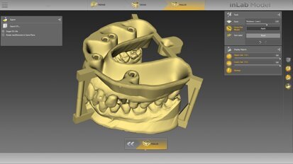 Nuove indicazioni, più funzioni: si aggiorna il software inLab 18.0