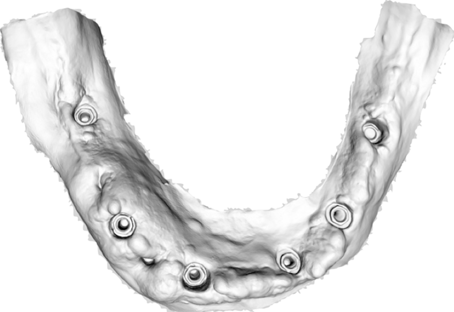Fig. 11