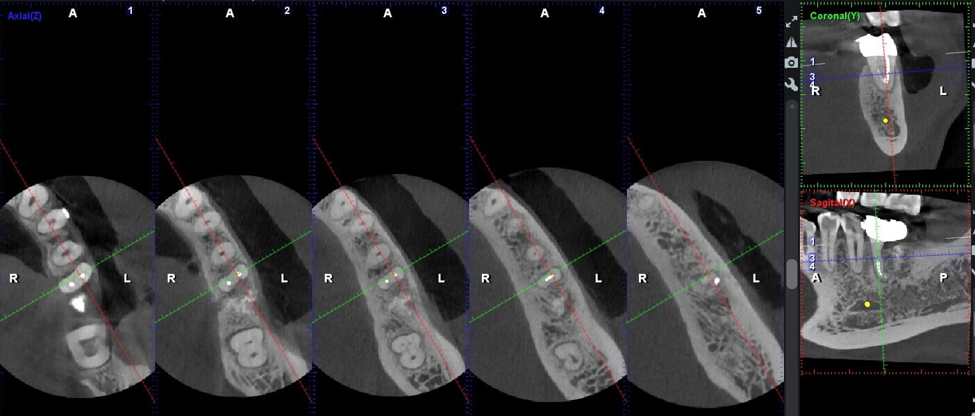 Fig. 15