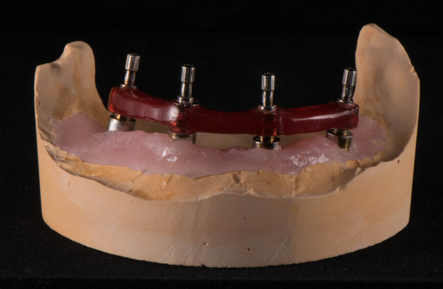 Fig. 26