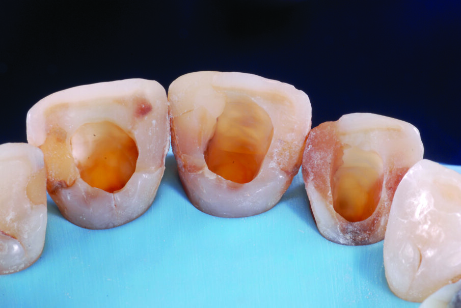 Fig. 8a