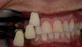 Afbeelding 6: Kleur bepalen met gepolariseerd licht.