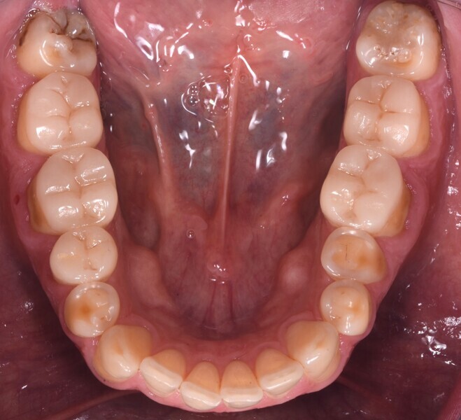 Fig. 2e.