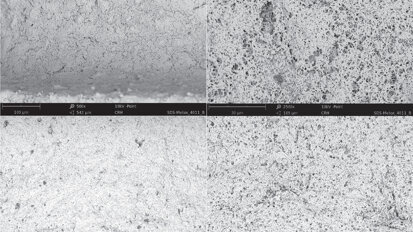 SEM surface analyses of 120 sterile-packed implants