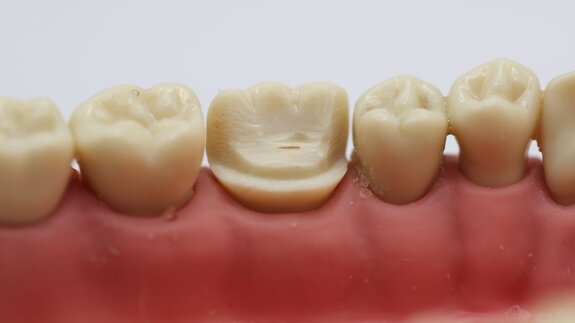 Blended dentistry: A workflow for merging conventional pinlay fundamentals with emerging technologies