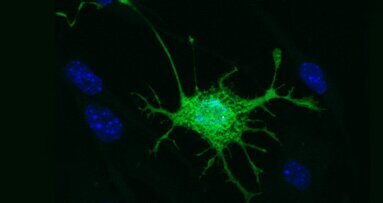 Célula-tronco da polpa dentária transformada em célula cerebral
