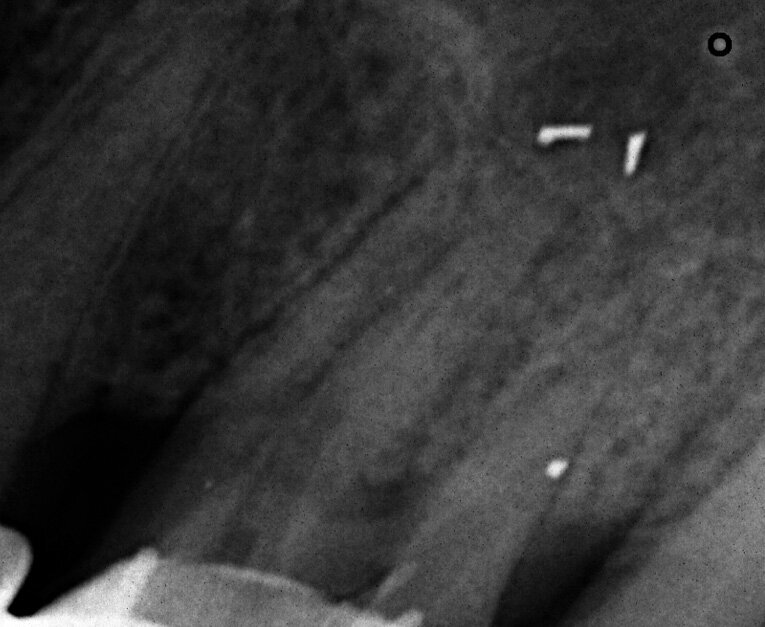 Fig. 17